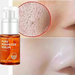 Pore Shrinking Essence 30ml – Oil Control & Hydration Serum for Balanced, Refined & Brighter Skin