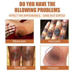 🌼 EELHOE Papaya Seed Oil 30ml – Fade Dark Spots, Even Skin Tone & Deep Moisturizing Body Oil for Hands, Legs & Joints